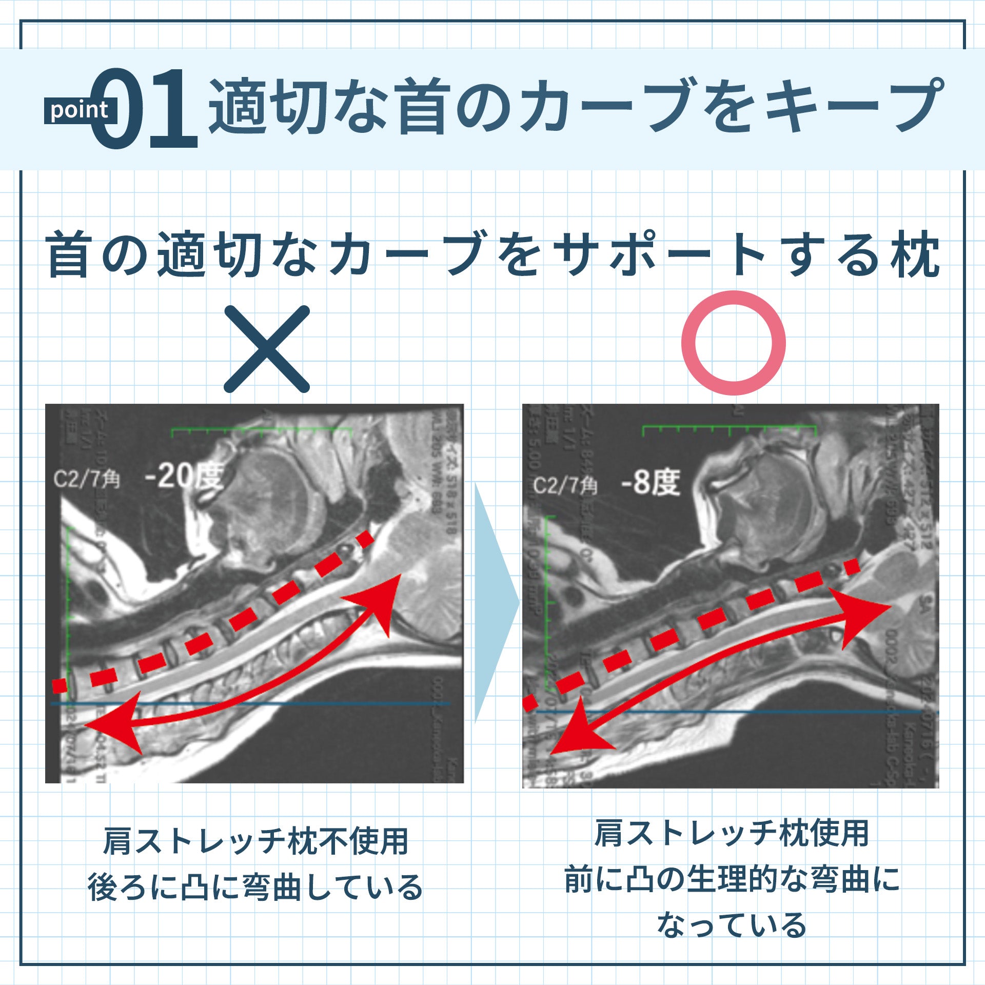 ロフテー　肩ストレッチ　枕 医師監修 肩ストレッチ枕 ピロー 肩こり解消 ストレートネック